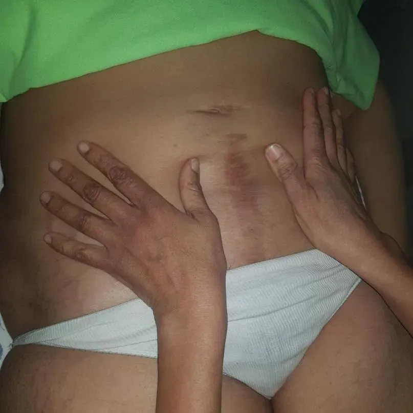 Soigner les blessures